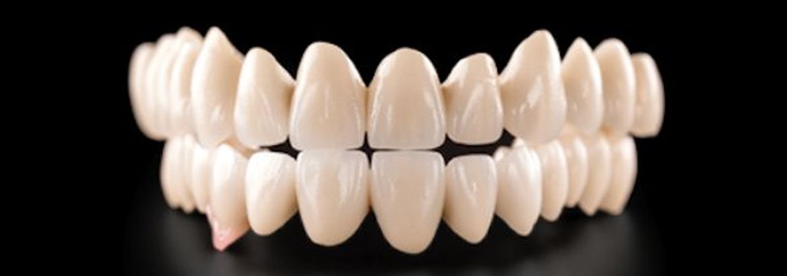 Digitally Designed Crowns