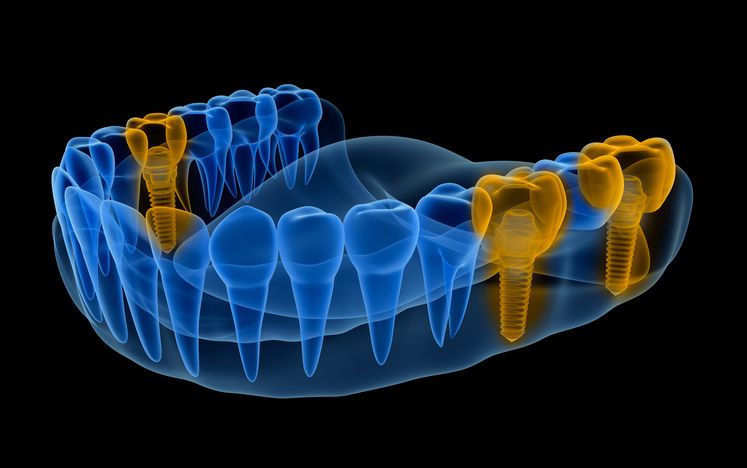 Digital Dentistry